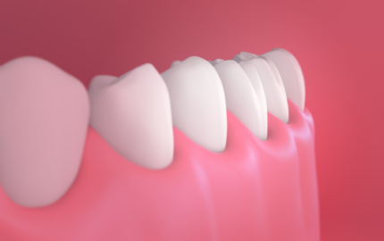 Diş Eti Tedavi Yöntemleri