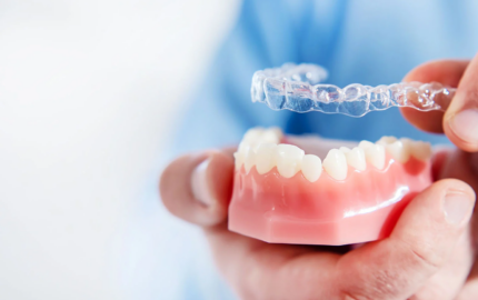 Invisalign Ortodonti Sistemi